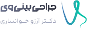 کلینیک جراحی بینی وی